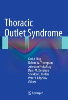 Thoracic Outlet Syndrome