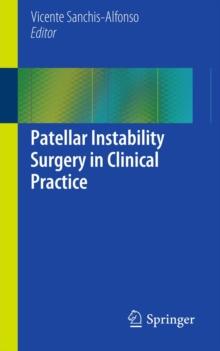 Patellar Instability Surgery in Clinical Practice