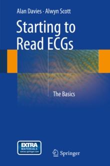 Starting to Read ECGs : The Basics