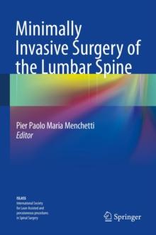 Minimally Invasive Surgery of the Lumbar Spine