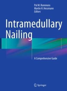 Intramedullary Nailing : A Comprehensive Guide