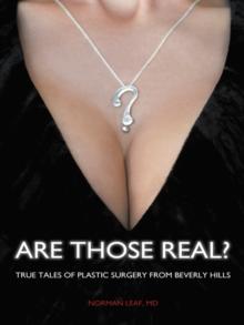 Are Those Real? : True Tales of Plastic Surgery from Beverly Hills