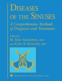 Diseases of the Sinuses : A Comprehensive Textbook of Diagnosis and Treatment