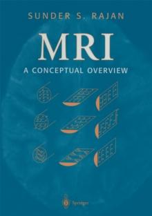 MRI : A Conceptual Overview