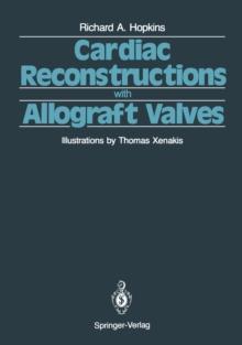 Cardiac Reconstructions with Allograft Valves