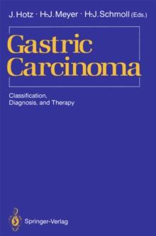 Gastric Carcinoma : Classification, Diagnosis, and Therapy