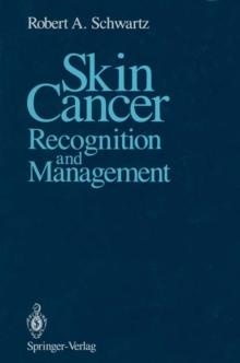 Skin Cancer : Recognition and Management