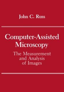 Computer-Assisted Microscopy : The Measurement and Analysis of Images