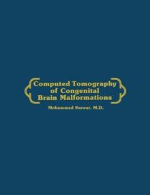 Computed Tomography of Congenital Brain Malformations