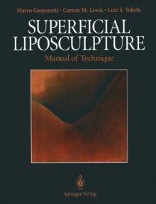 Superficial Liposculpture : Manual of Technique