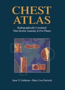 Chest Atlas : Radiographically Correlated Thin-Section Anatomy in Five Planes