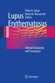 Lupus Erythematosus : Clinical Evaluation and Treatment