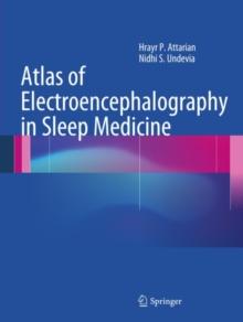 Atlas of Electroencephalography in Sleep Medicine