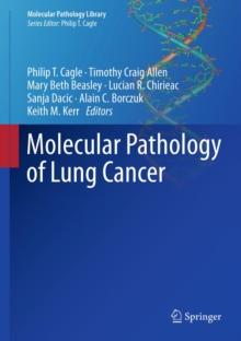 Molecular Pathology of Lung Cancer