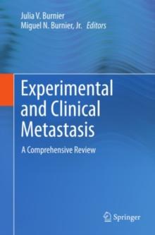 Experimental and Clinical Metastasis : A Comprehensive Review