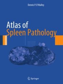 Atlas of Spleen Pathology