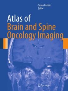 Atlas of Brain and Spine Oncology Imaging