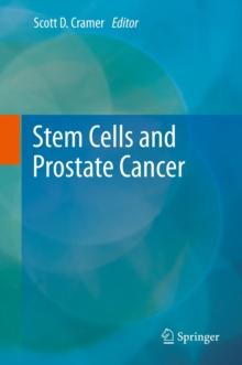 Stem Cells and Prostate Cancer