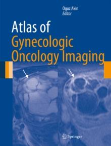 Atlas of Gynecologic Oncology Imaging