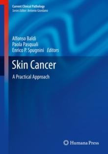 Skin Cancer : A Practical Approach