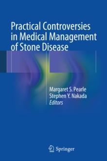 Practical Controversies in Medical Management of Stone Disease