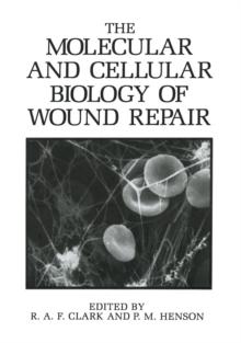 The Molecular and Cellular Biology of Wound Repair