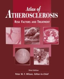 Atlas of Atherosclerosis : Risk Factors and Treatment