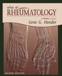 Atlas of Rheumatology