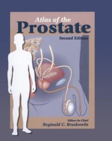 Atlas of the Prostate