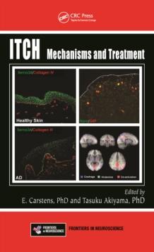 Itch : Mechanisms and Treatment