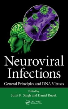 Neuroviral Infections : General Principles and DNA Viruses