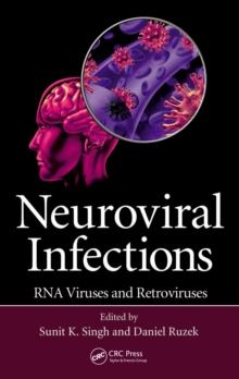 Neuroviral Infections : RNA Viruses and Retroviruses