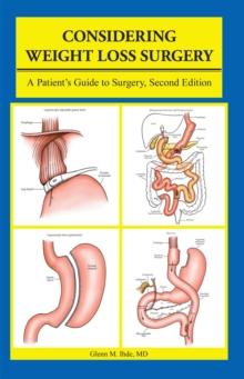 Considering Weight Loss Surgery : A Patient'S Guide to Surgery, Second Edition