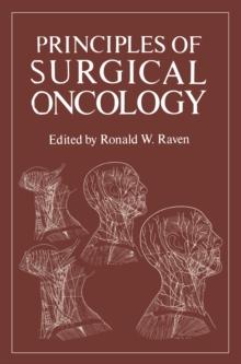 Principles of Surgical Oncology