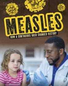 Measles : How a Contagious Rash Changed History