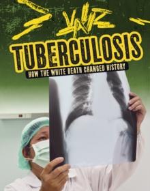 Tuberculosis : How the White Death Changed History