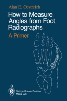 How to Measure Angles from Foot Radiographs : A Primer