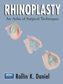 Rhinoplasty : An Atlas of Surgical Techniques