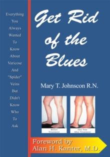 Get Rid of the Blues : Everything You Always Wanted to Know About Varicose and Spider Veins but Didn't Know Who to Ask