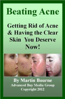 Beating Acne: Getting Rid of Acne & Having the Skin You Deserve Now!