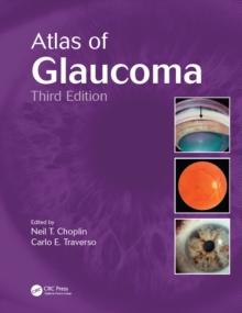 Atlas of Glaucoma