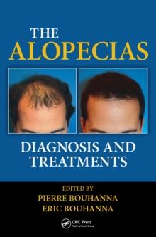 The Alopecias : Diagnosis and Treatments