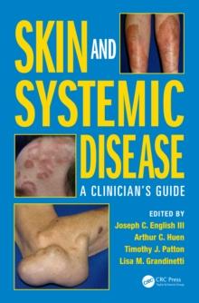 Skin and Systemic Disease : A Clinicians Guide