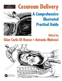 Cesarean Delivery : A Comprehensive Illustrated Practical Guide