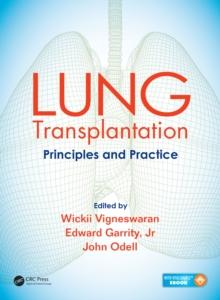 Lung Transplantation : Principles and Practice