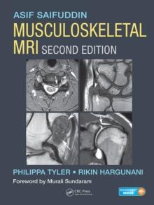 Musculoskeletal MRI