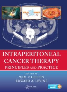 Intraperitoneal Cancer Therapy : Principles and Practice