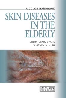 Skin Diseases in the Elderly : A Color Handbook