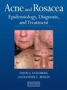 Acne and Rosacea : Epidemiology, Diagnosis and Treatment