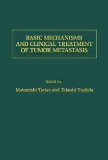 Basic Mechanisms and Clinical Treatment of Tumor Metastasis